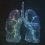 Lung cancer